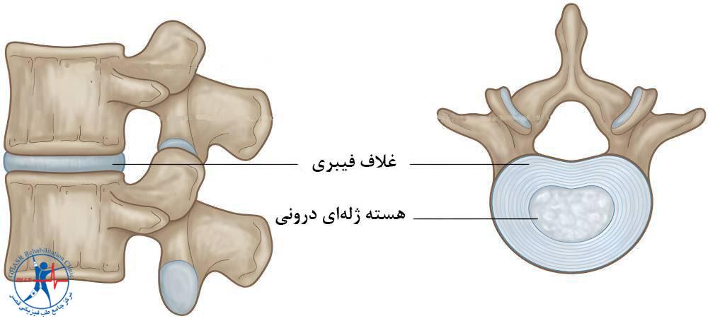 دیسک گردن چیست
