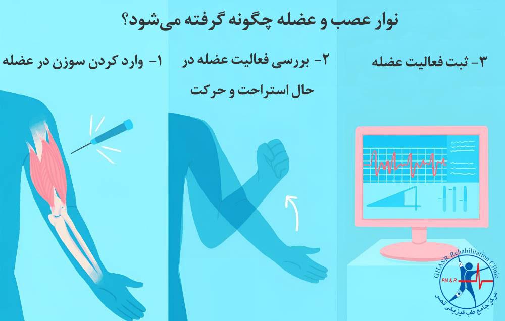 فرآیند گرفتن نوار عصب و عضله