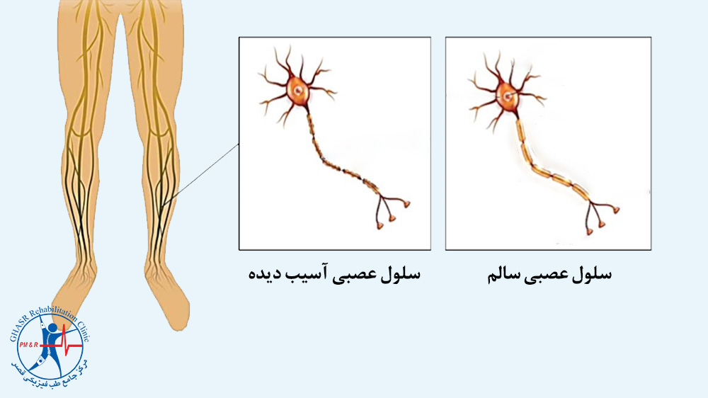 بیماریهای خودایمنی